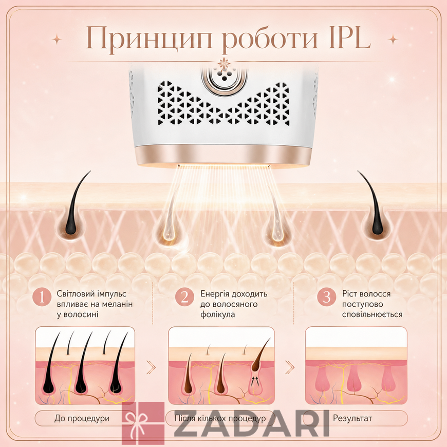Фотоепілятор жіночий лазерний епілятор з функцією охолодження, Фотоепілятор для тіла ніг рук обличчя зони бікіні IPL2506W
